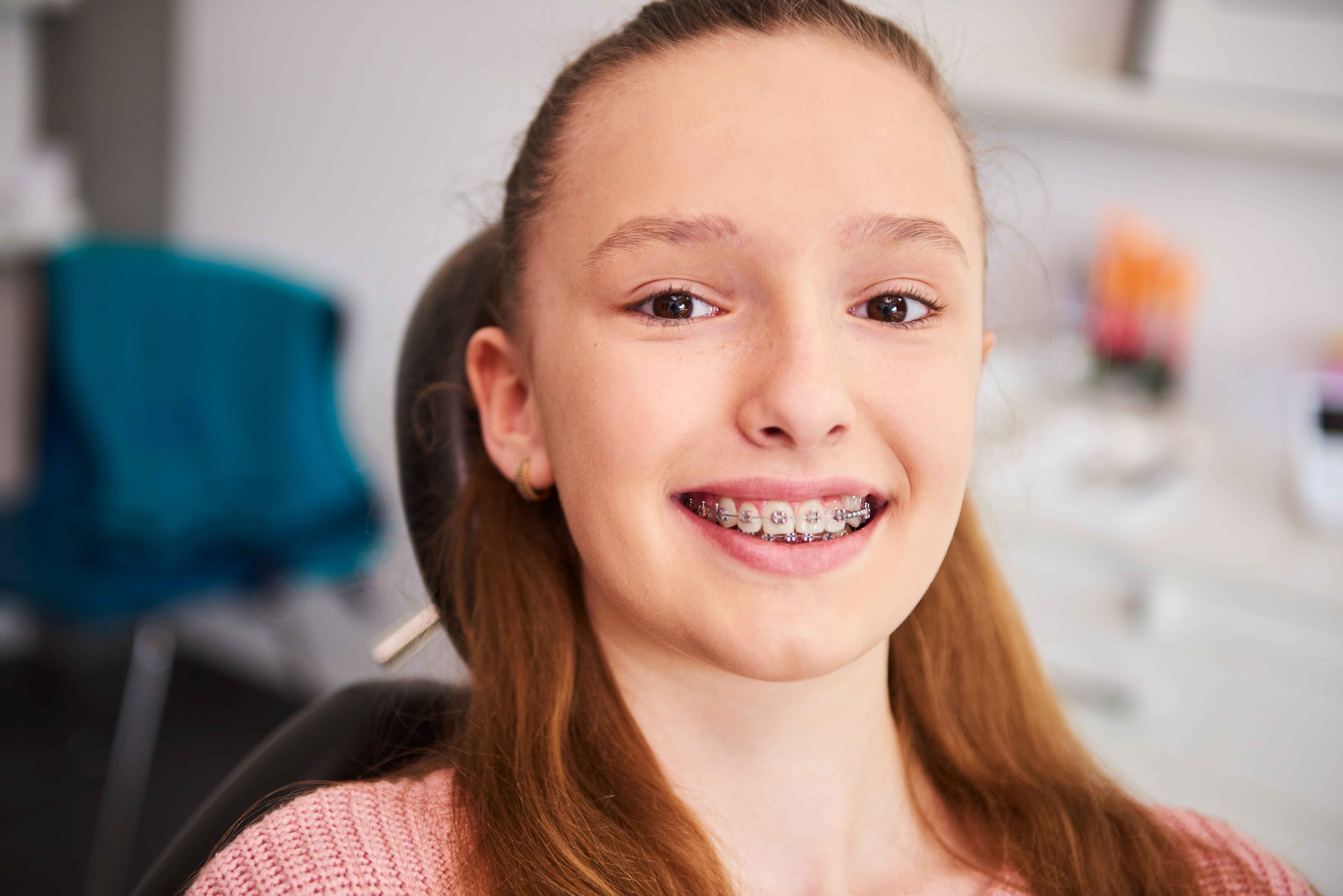 Benefits of Braces & Aligners