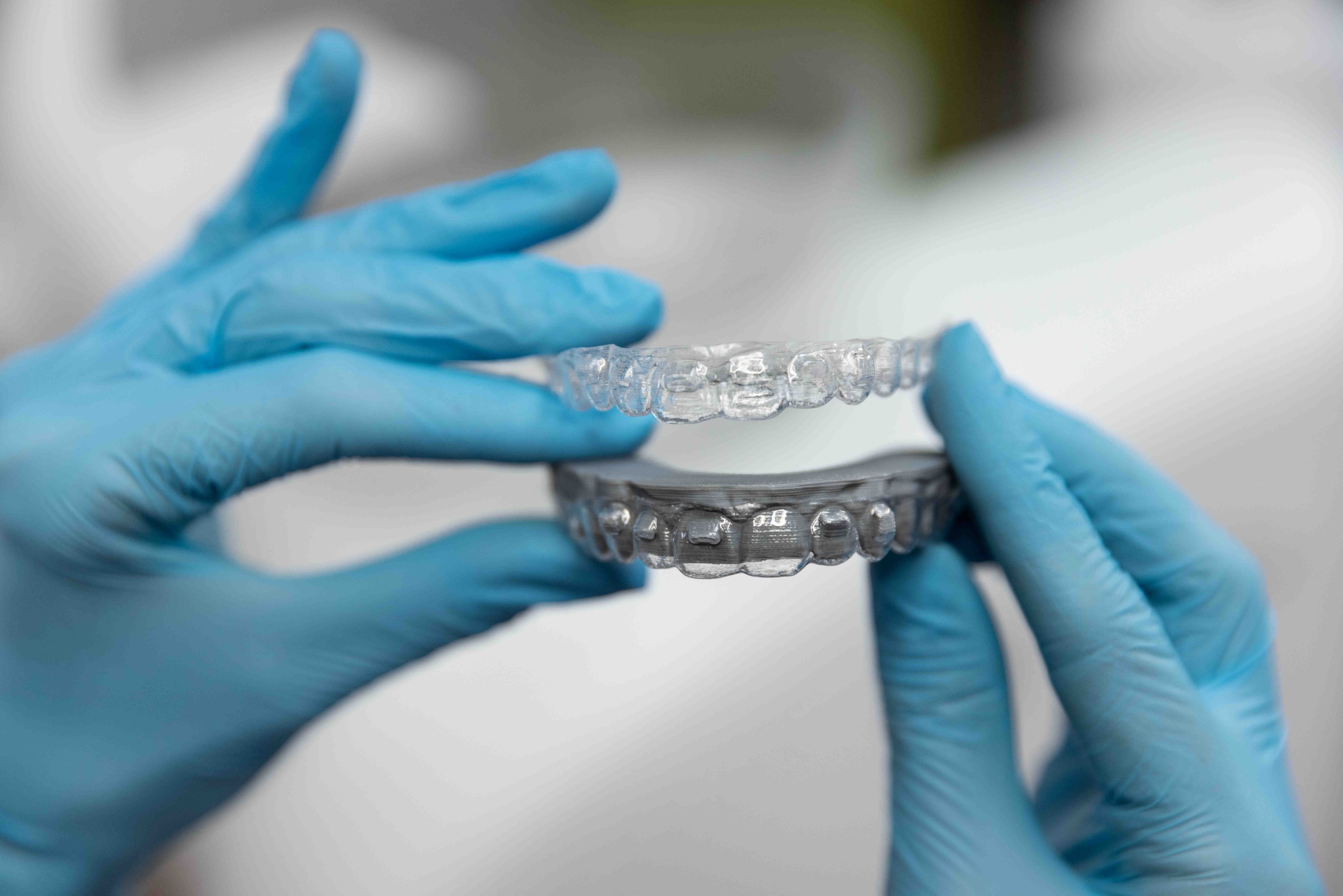 Common Braces & Aligners Procedures