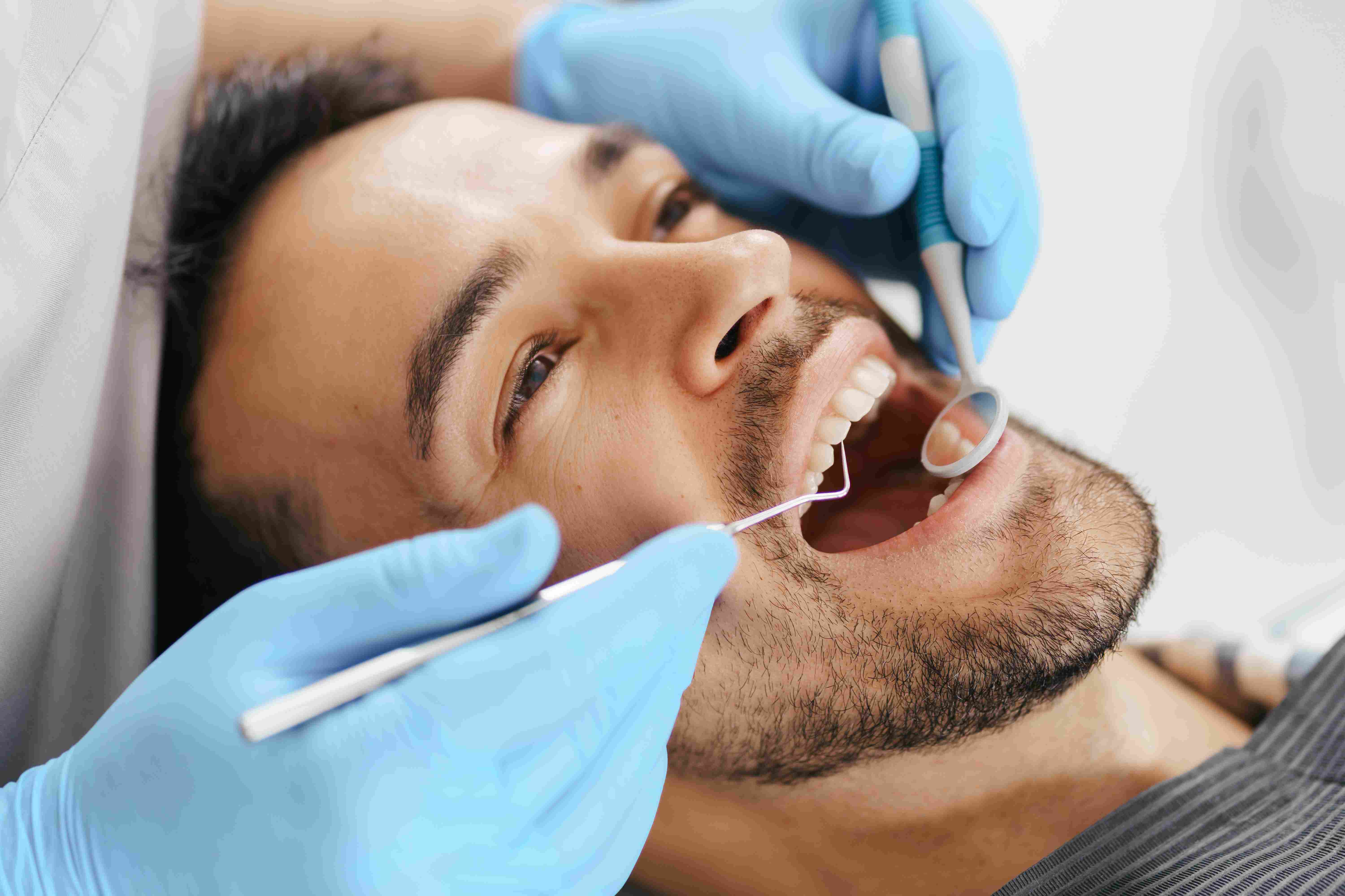 What to Expect During the Scaling & Filling Procedure