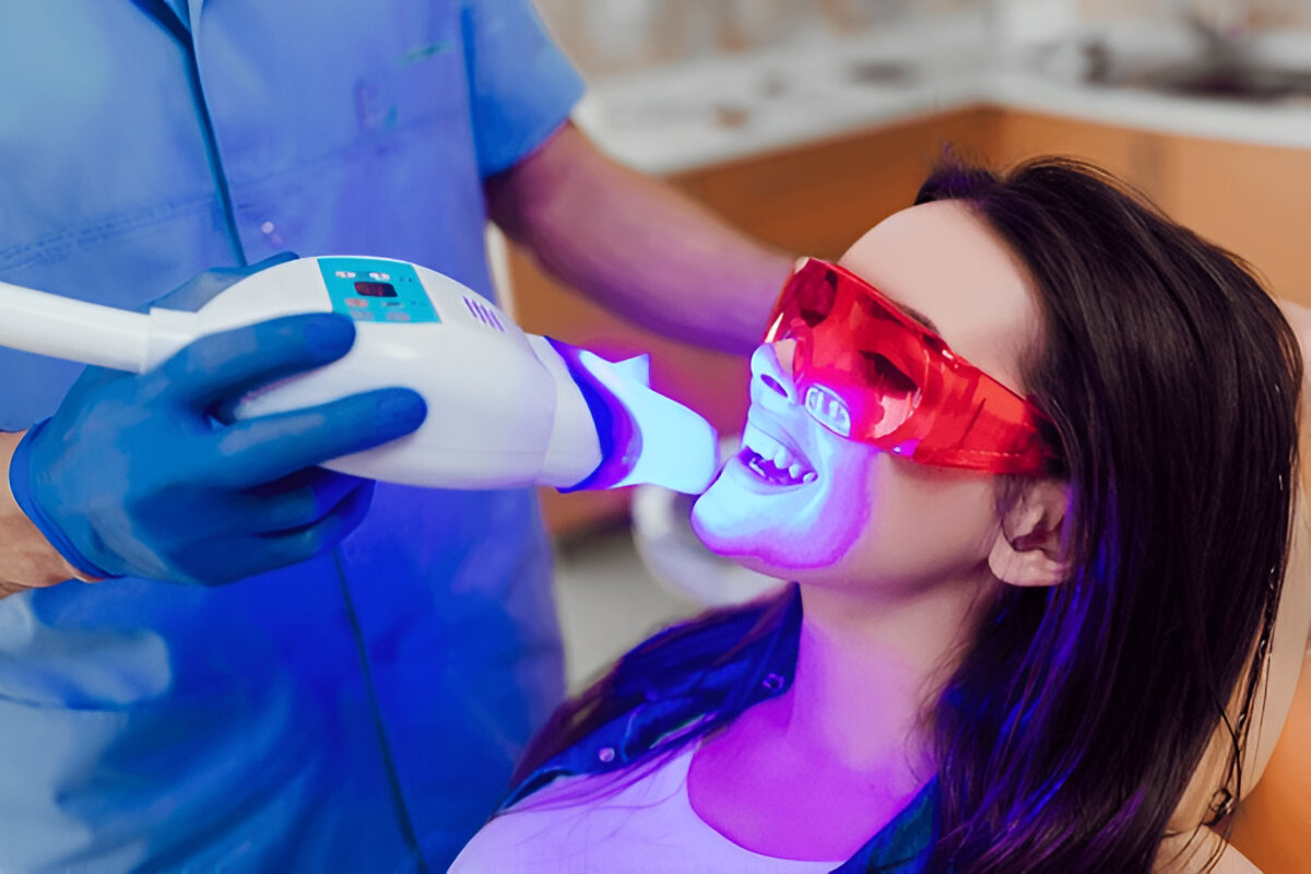 What is Teeth Whitening?