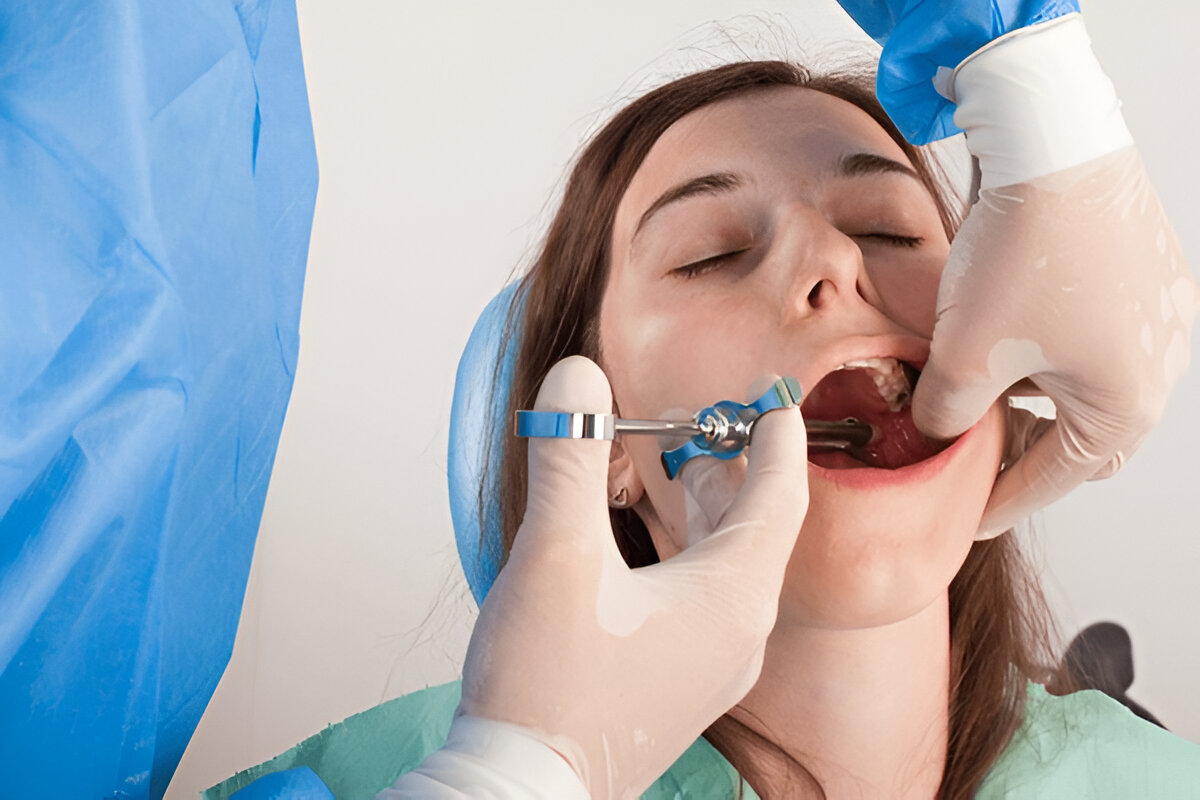 Benefits of Minor Dental Surgeries