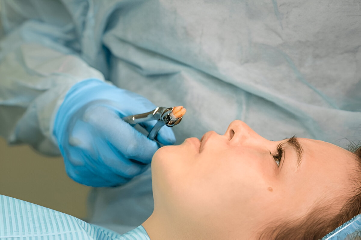 Who Needs Minor Dental Surgeries?