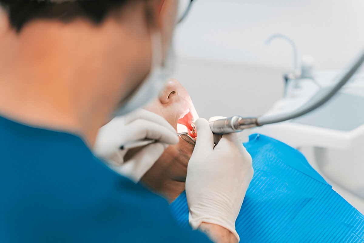 Common Minor Dental Surgery Procedures