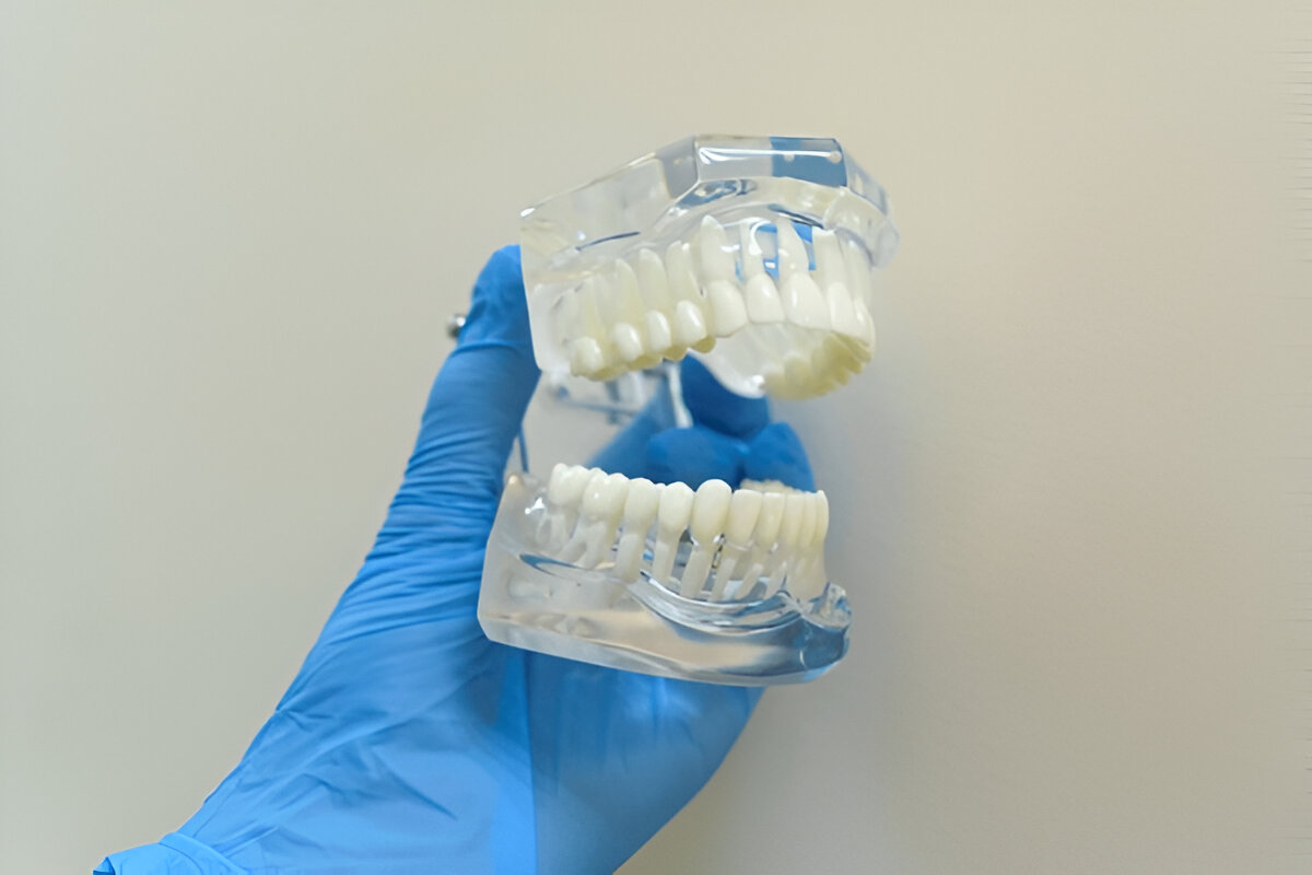 Dental Crown & Bridge