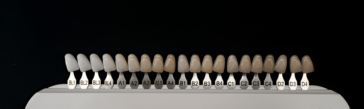 Types of Veneers